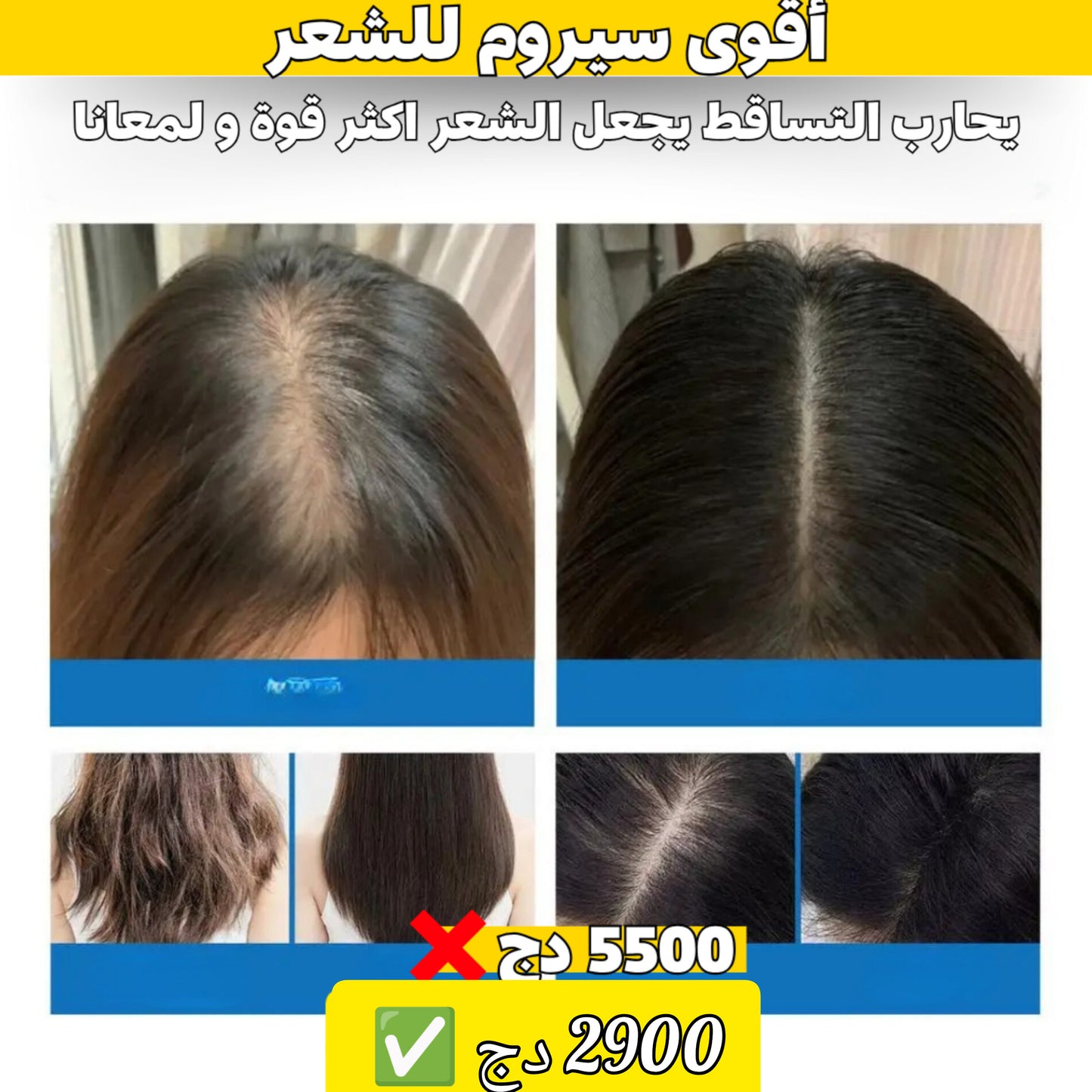 اقوى سيروم لعلاج تساقط الشعر