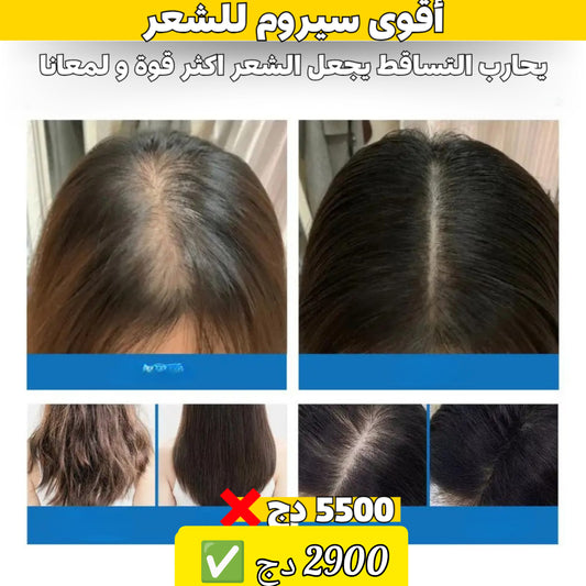 اقوى سيروم لعلاج تساقط الشعر